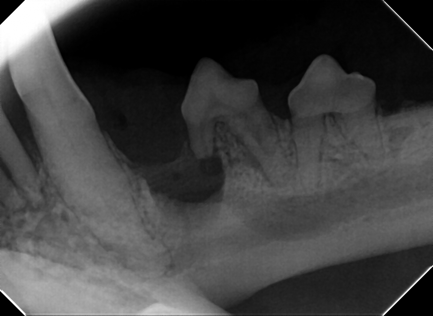 Dental X-ray